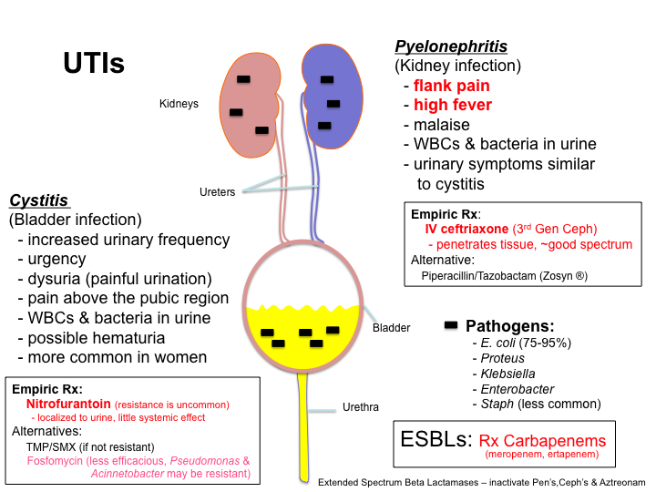 UTI/Pyelonephritis