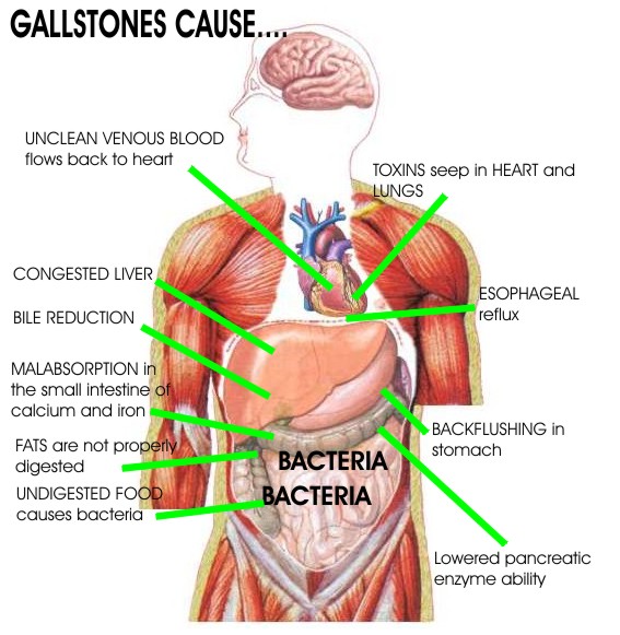 What are Gall Bladder (Gallstones) Symptoms