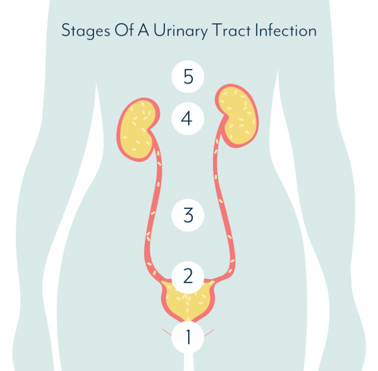 What Causes A Urinary Tract Infection? How Do You Clear UTI?