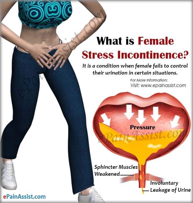 What is Female Stress Incontinence