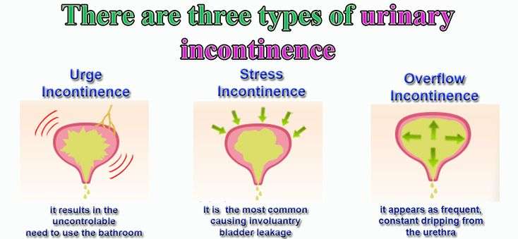 What is Urinary Incontinence