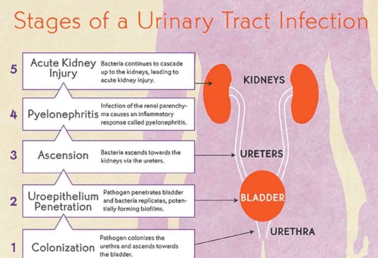 What is Urinary Track Infections  NandiniDoctors