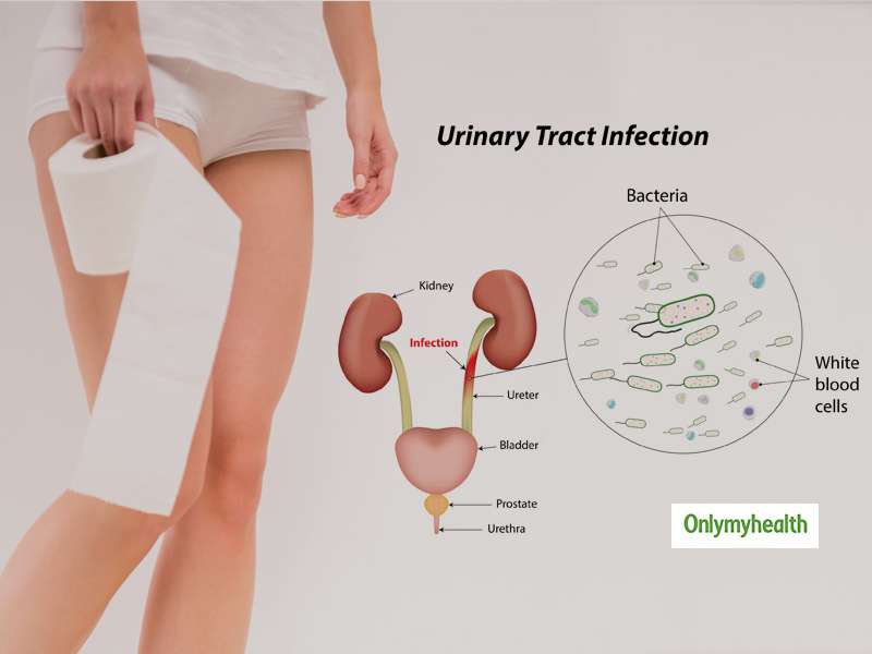 What Is Urinary Tract Infection (UTI)? Here Are Its Causes ...