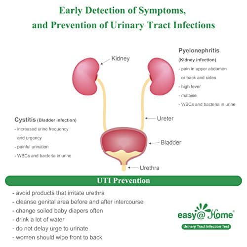 Woman Kidney Infection Pain Location