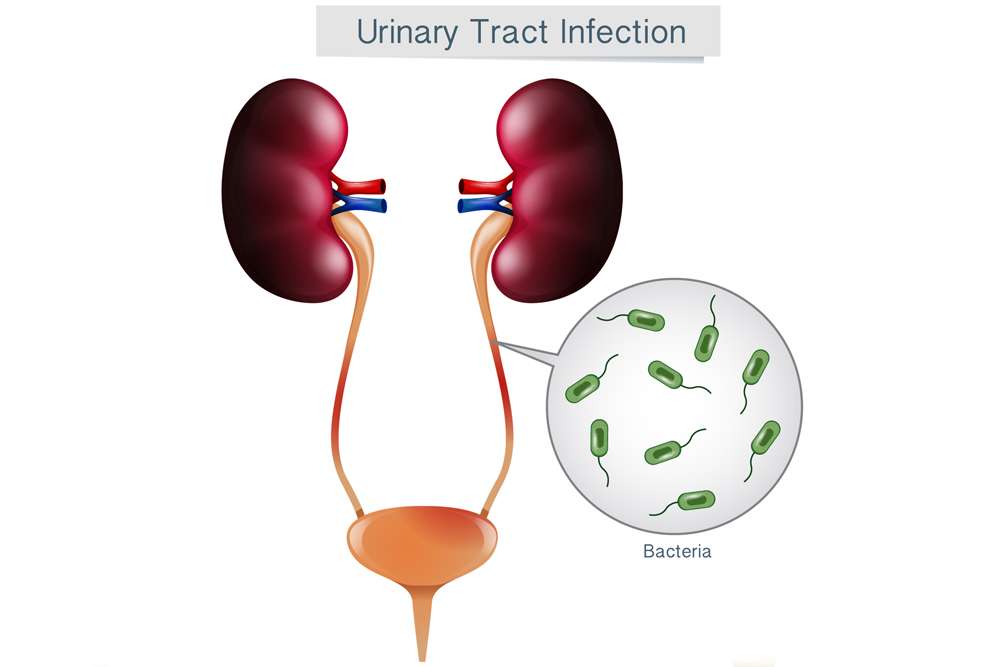 YUA Health Message: Things to know about Urinary Tract Infections ...